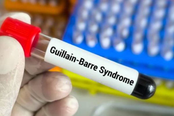 Guillain-Barré Syndrome, Causes, Symptoms, Treatment and Recovery