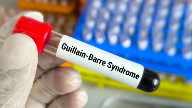 Guillain-Barré Syndrome, Causes, Symptoms, Treatment and Recovery